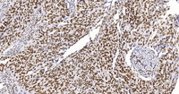 免疫组化IHC